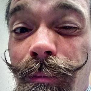 Meet your Posher, Franz